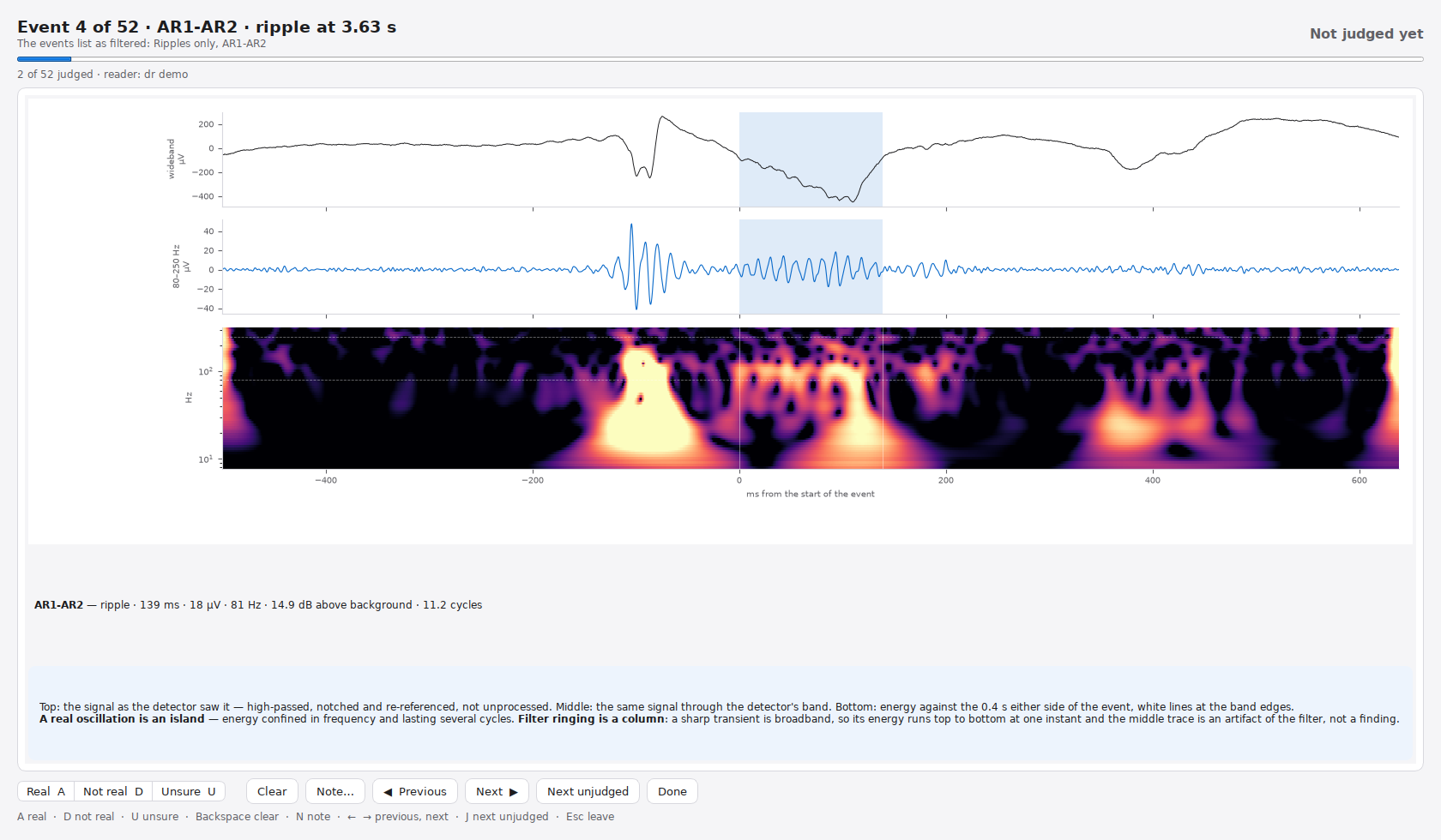Review mode: one ripple shown as wideband signal, band-passed signal and time-frequency map on a shared time axis, with Real, Not real and Unsure controls.